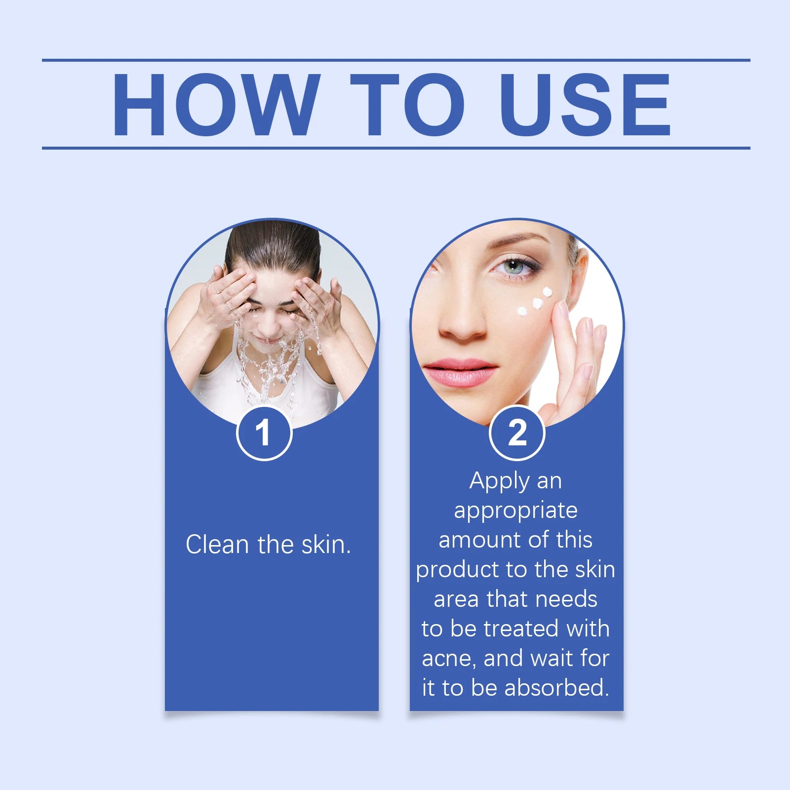 South Moon Herbal Acne Cream 20g