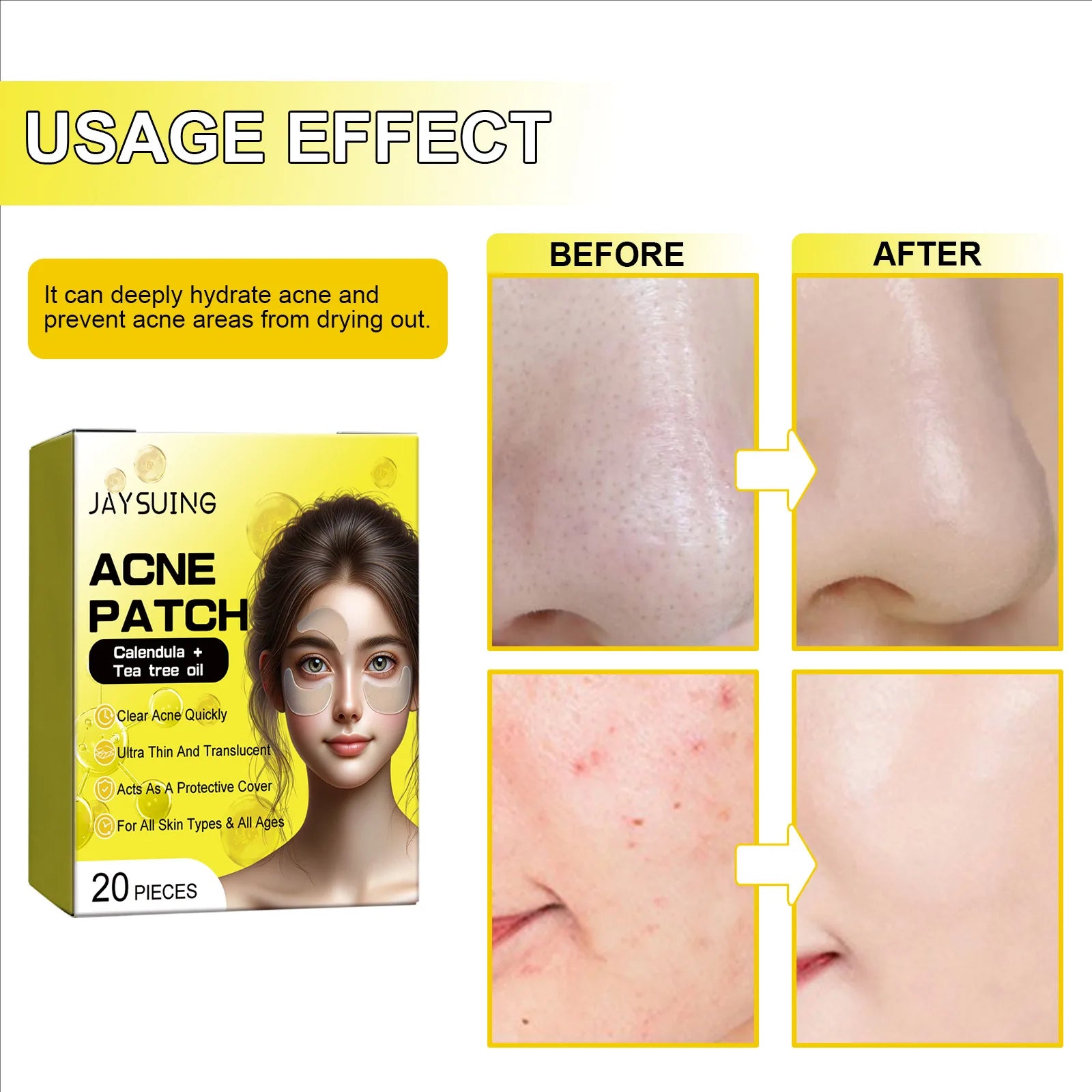 Invisible Acne Dots Pimple Patch Stickers