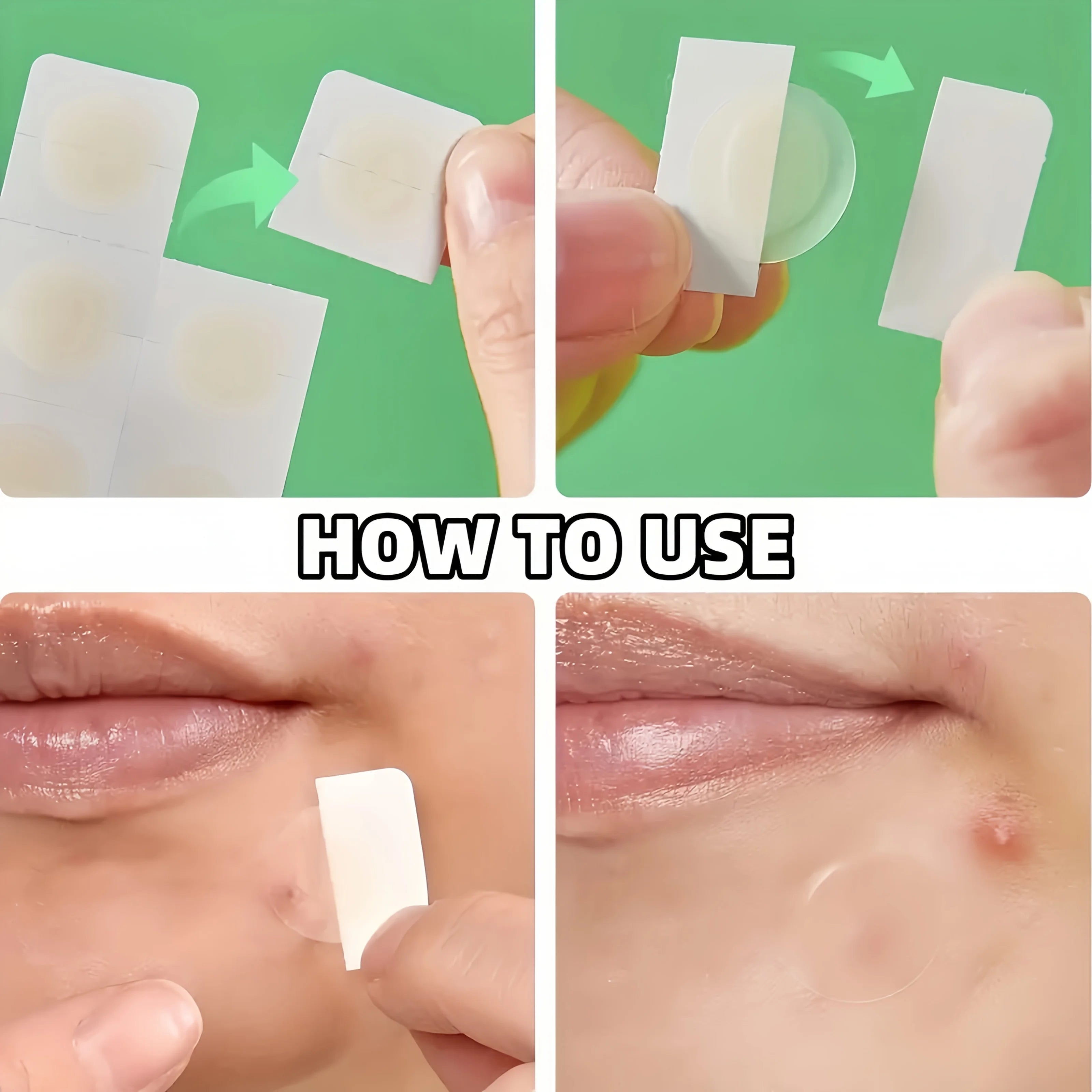 48 Stück unsichtbare Akne-Pickel-Patch-Aufkleber