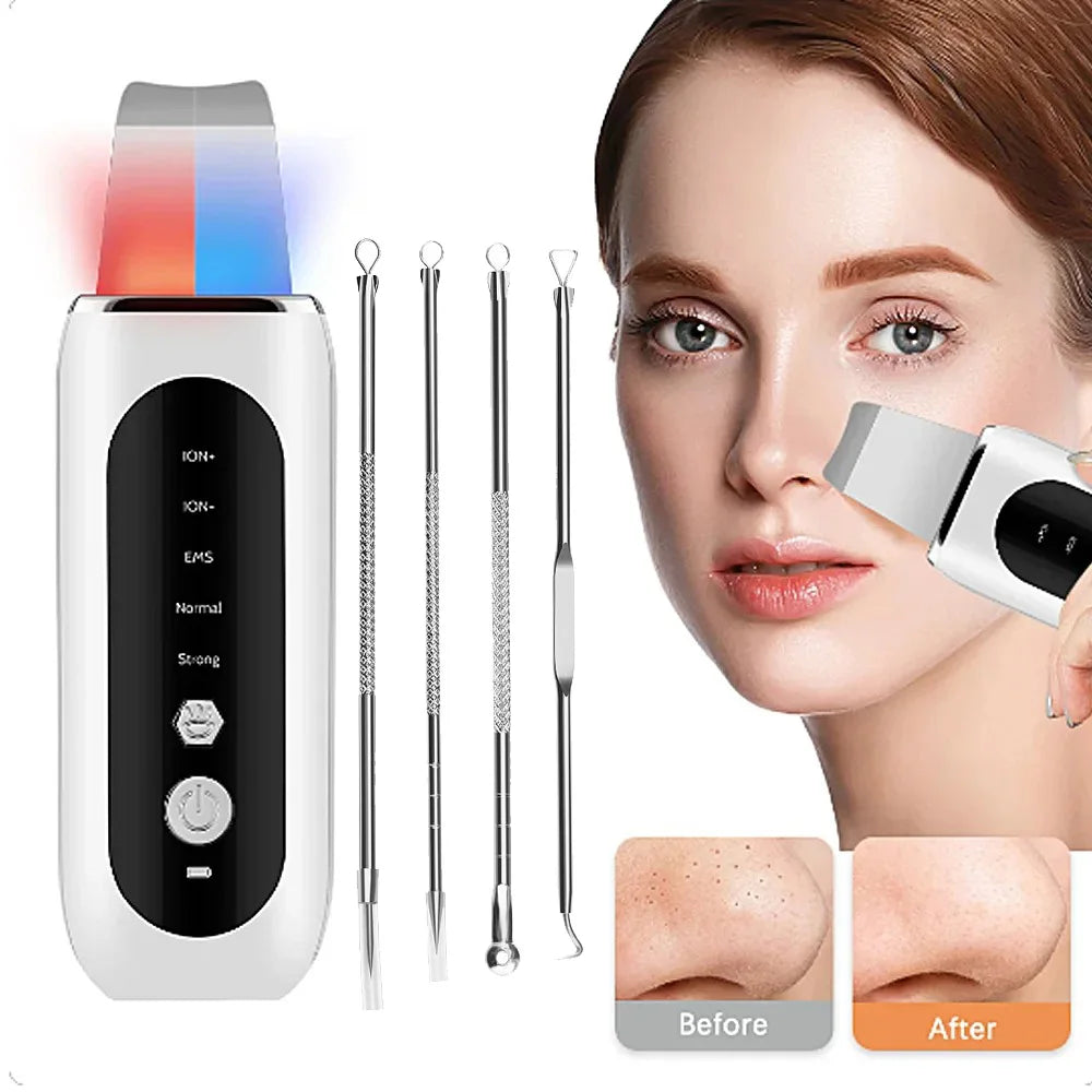 Ultrasonic Skin Scrubber LED EMS