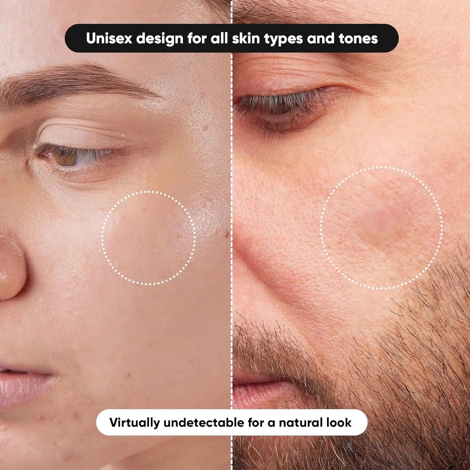 800PCS Invisible Acne Pimple Patches