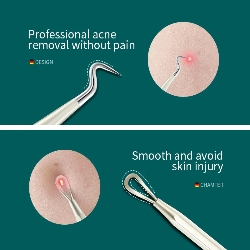 MR.GREEN Blackhead & Acne Removal Set