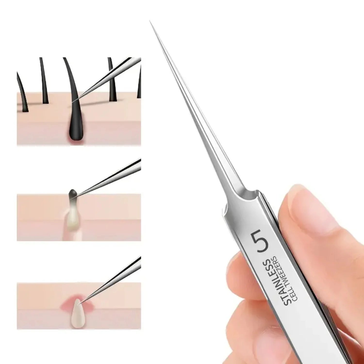 Ultra-fine Blackhead & Pimple Tweezers