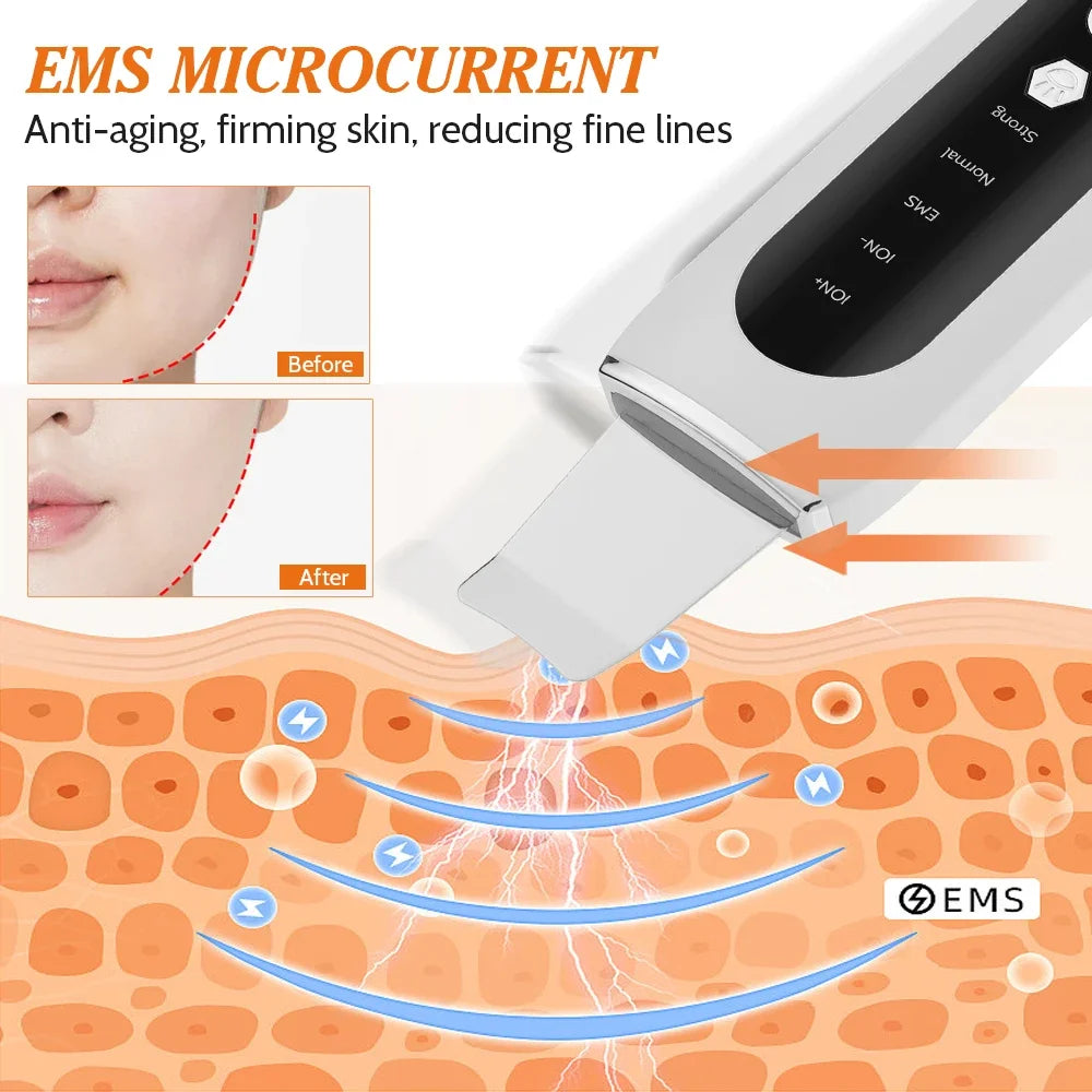 Ultrasonic Skin Scrubber LED EMS
