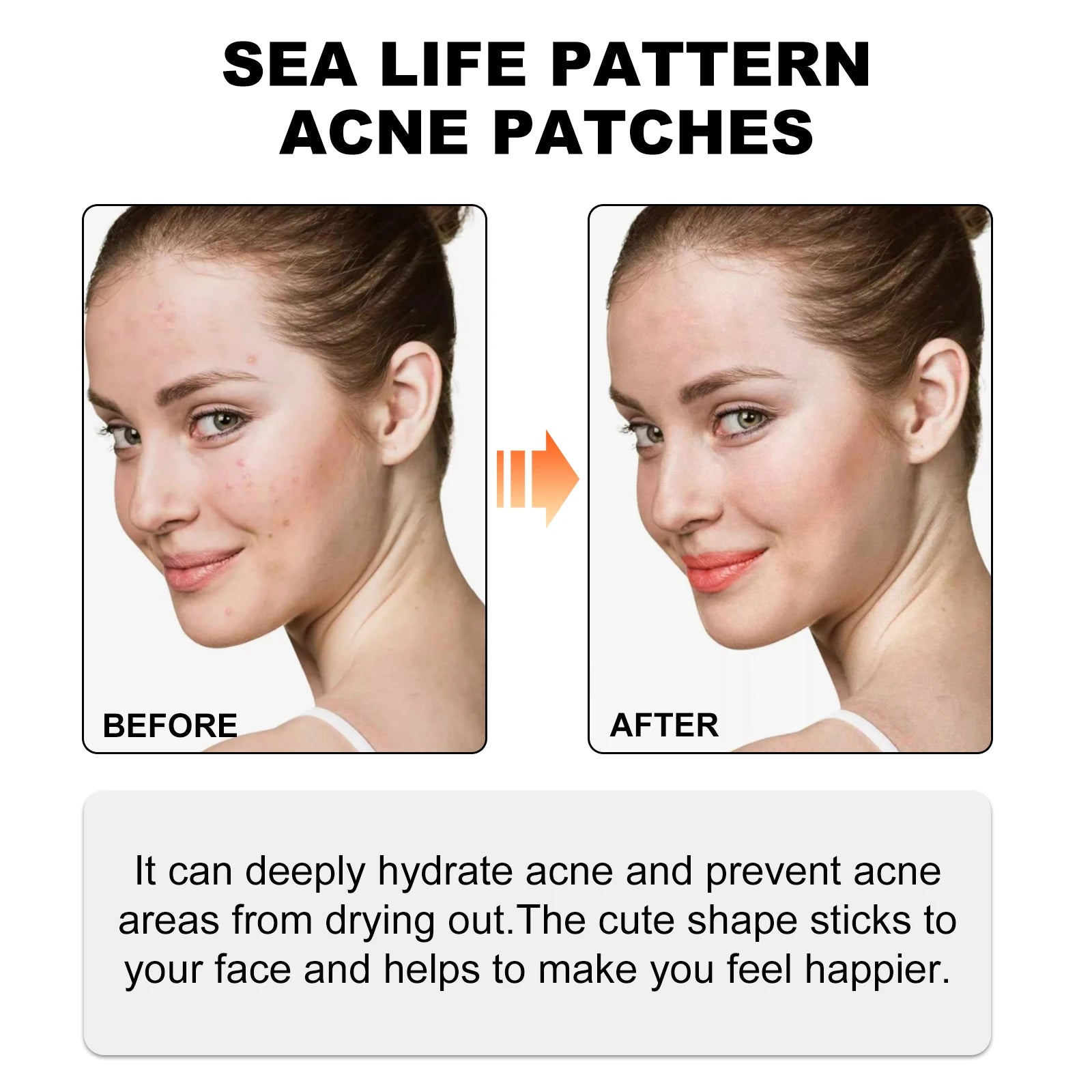 Hoygi Cute Color Acne Care Patches
