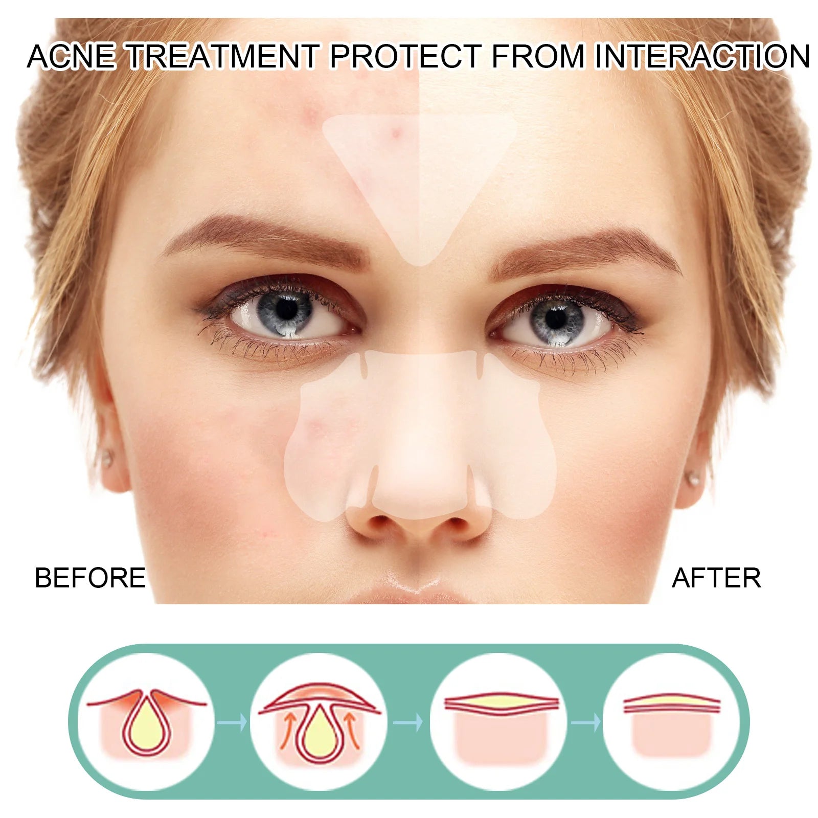 EELHOE Full Face Acne Relief Patch