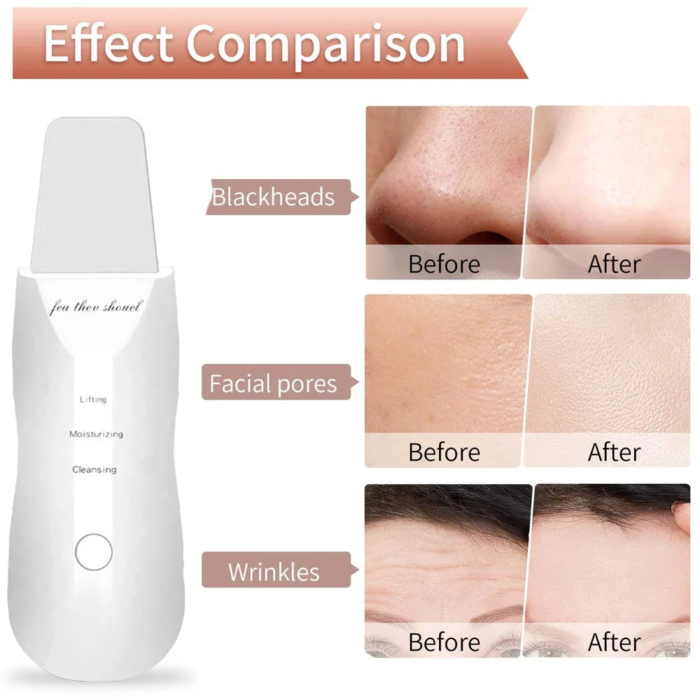 Skin Scrubber Blackhead Remover Tool