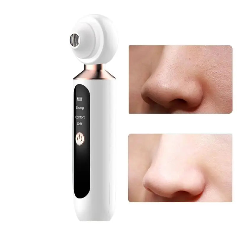Blackhead Vacuum Pore Cleaner Device