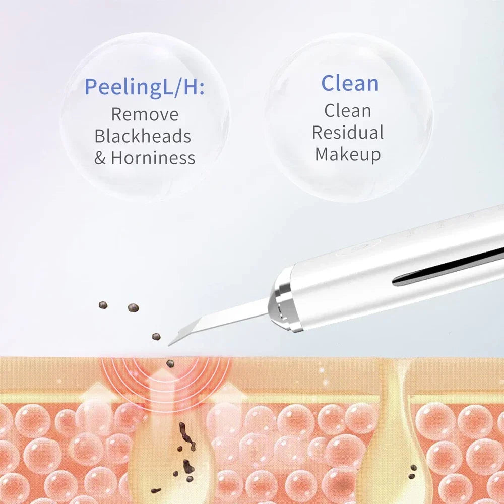 Skin Scrubber Blackhead Remover Tool