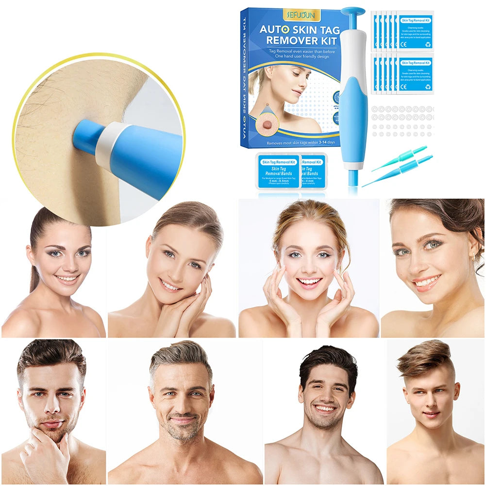 Rubber Rings Skin Tag Removal Tool