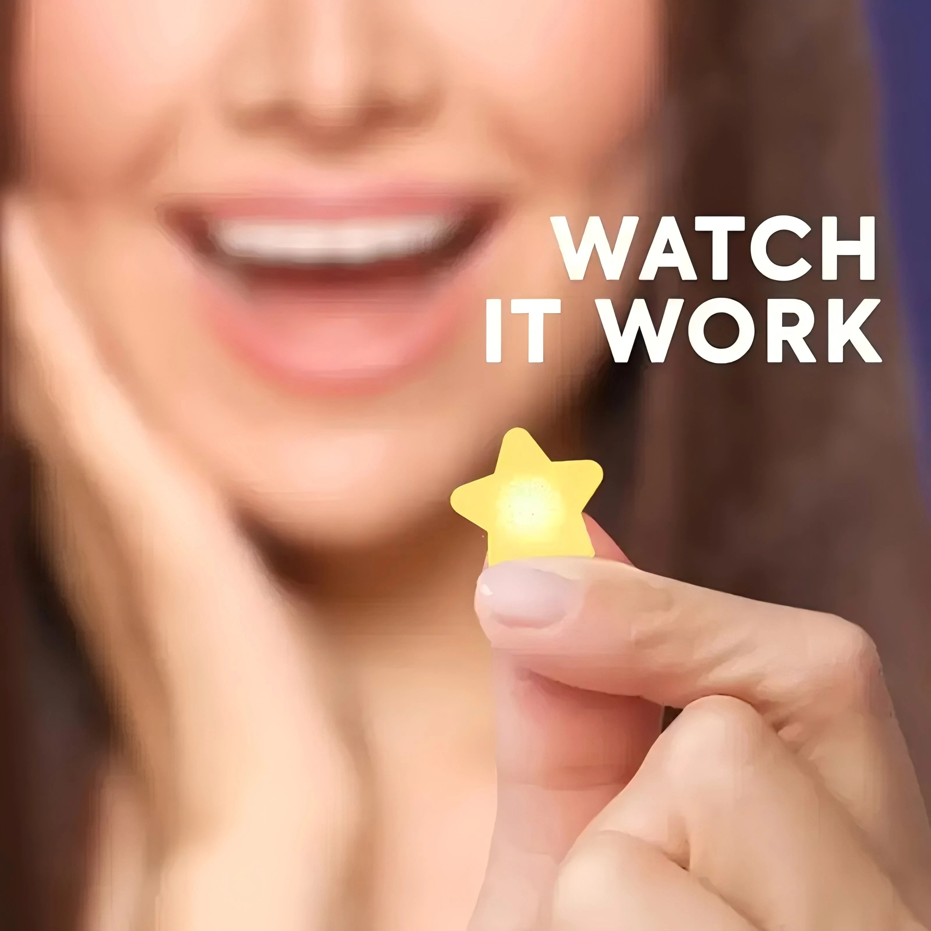 240pcs Star Yellow Acne Patch Set