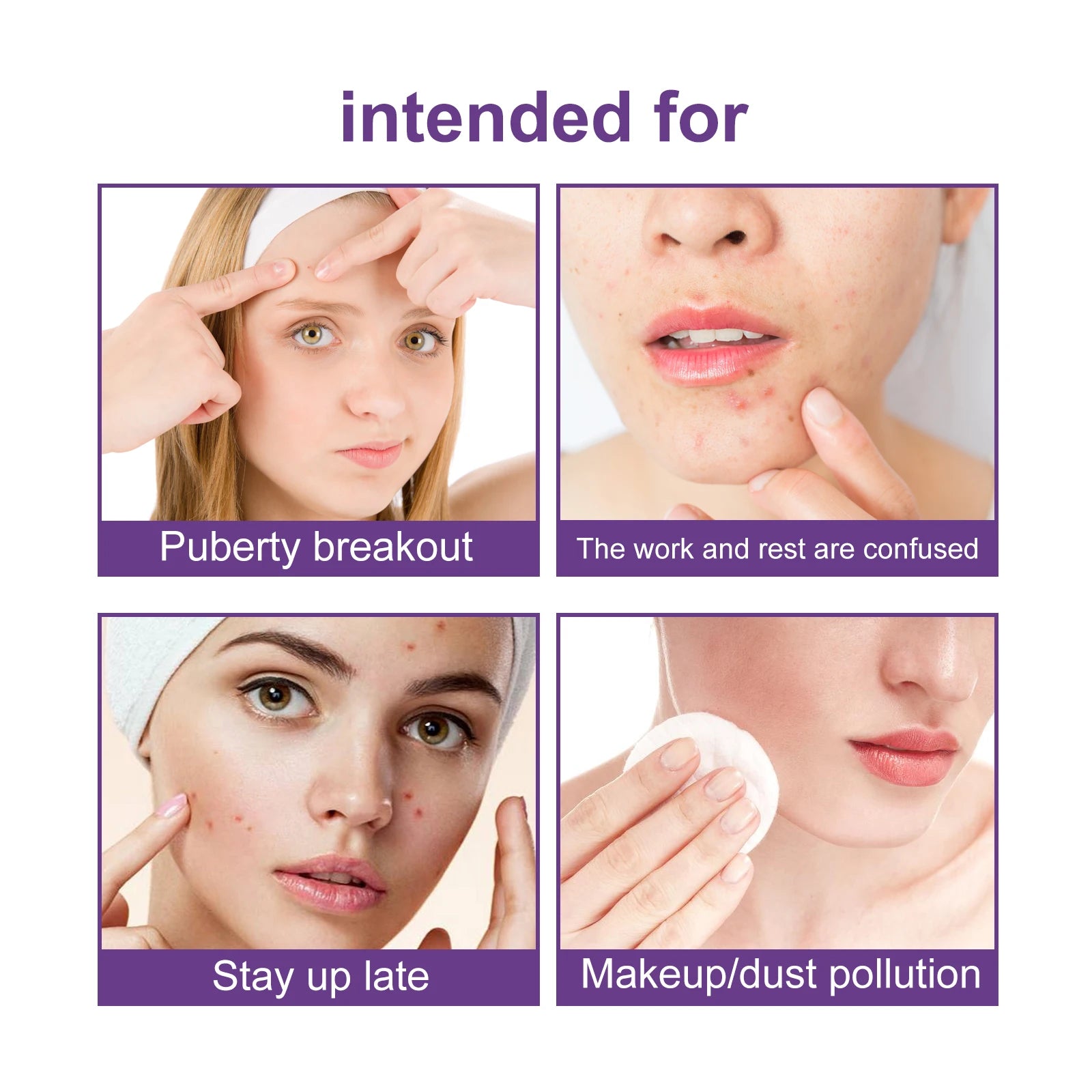180Pcs Water Gel Acne Patch Set